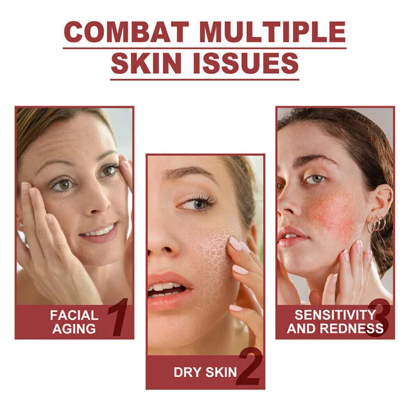 Skynpure-Pure Films,Highprim Collagen Film Mask For Forehead Chee